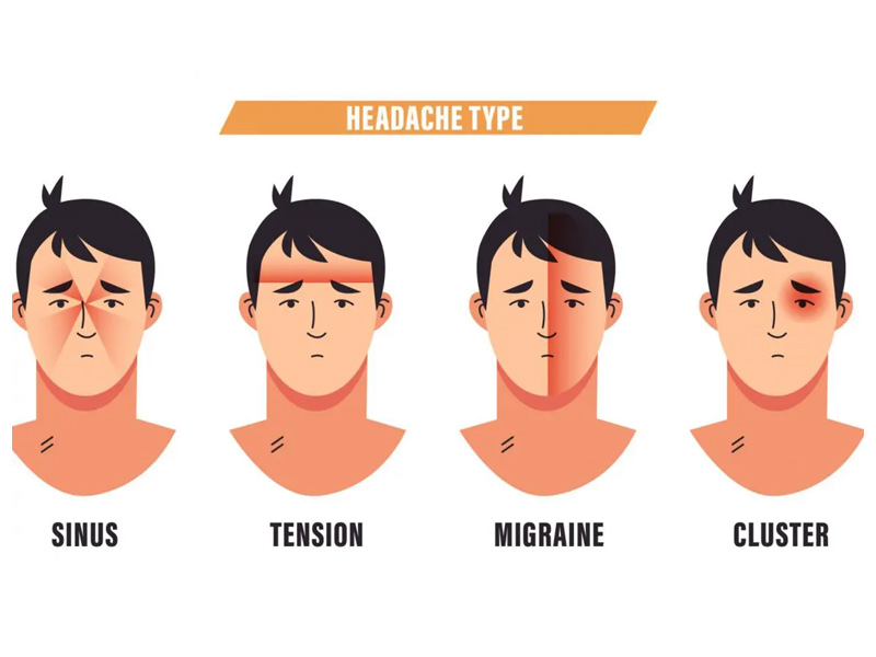 4 Common Types Of Headaches Aiello Family Chiropractic Aiello   4 Common 