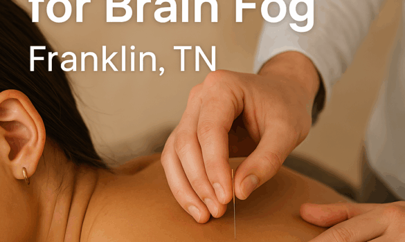 acupuncture for brain fog
