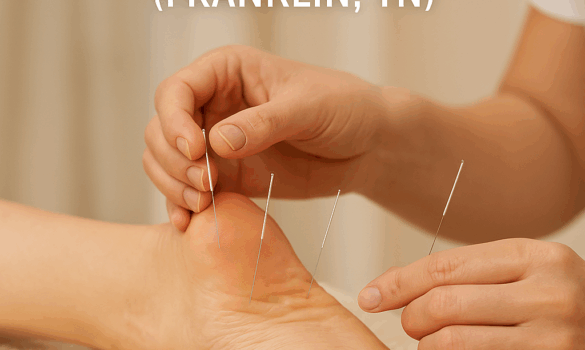 acupuncture for plantar fasciitis